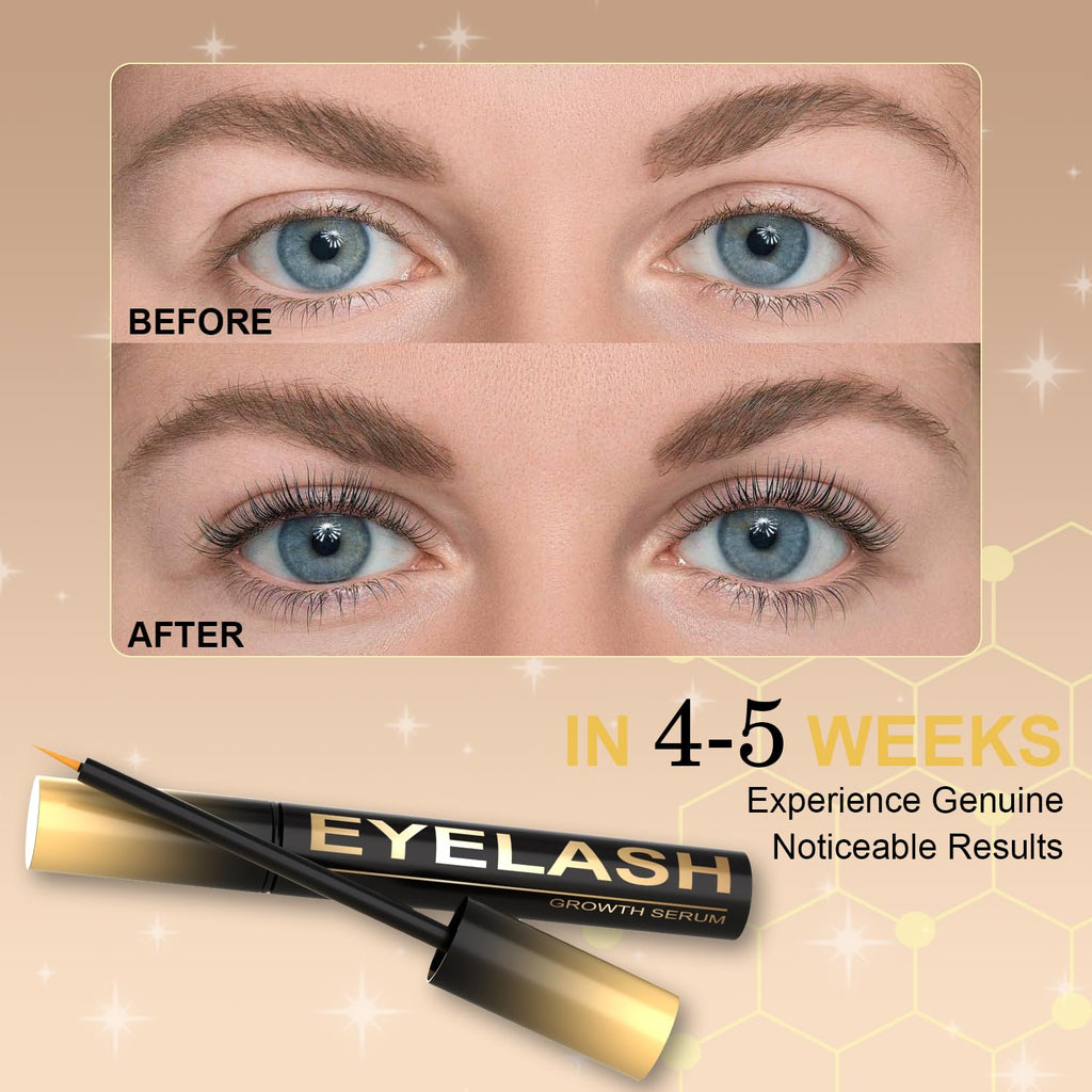 Tistees Lash Serum – Premium Eyelash Growth Serum for Longer, Fuller Lashes (5 mL)