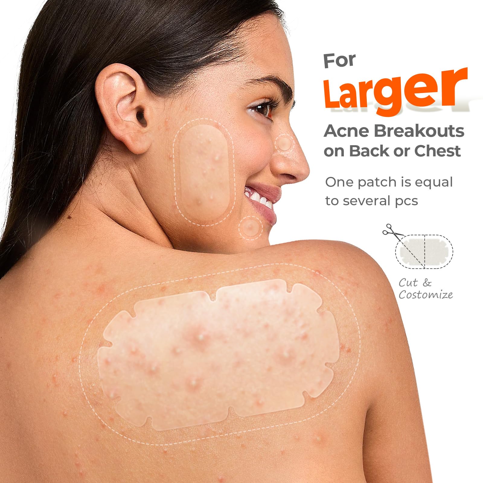 TKTK XXL Body Acne Patches – 5 Sizes, 260 Large Hydrocolloid Patches for Back, Chest & Shoulders