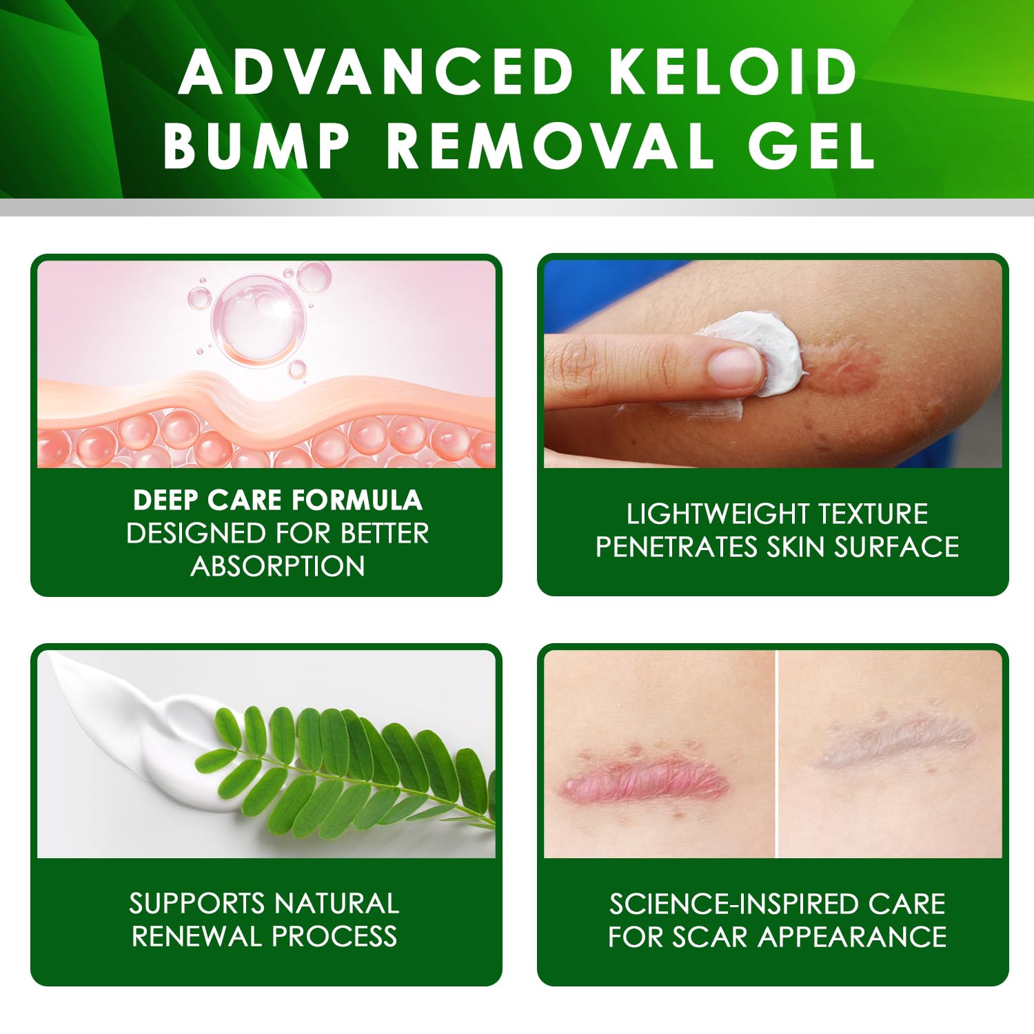 Tobcharm Advanced Keloid Scar Gel – Silicone Scar Care, 2-Pack (30g x2)