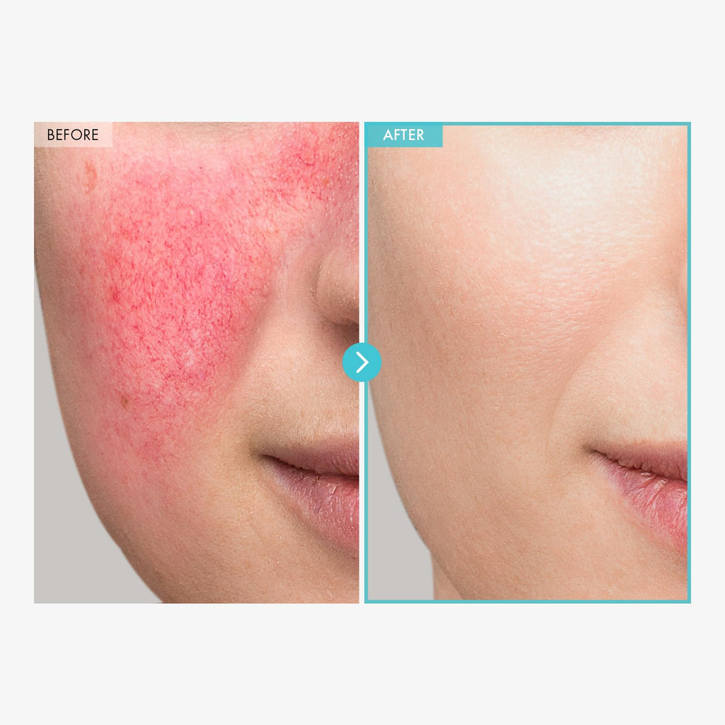 TOSOWOONG SOS Repair CICA Clinic Zinc Cream 50g – 10% Zinc Oxide for Barrier Repair & Soothing