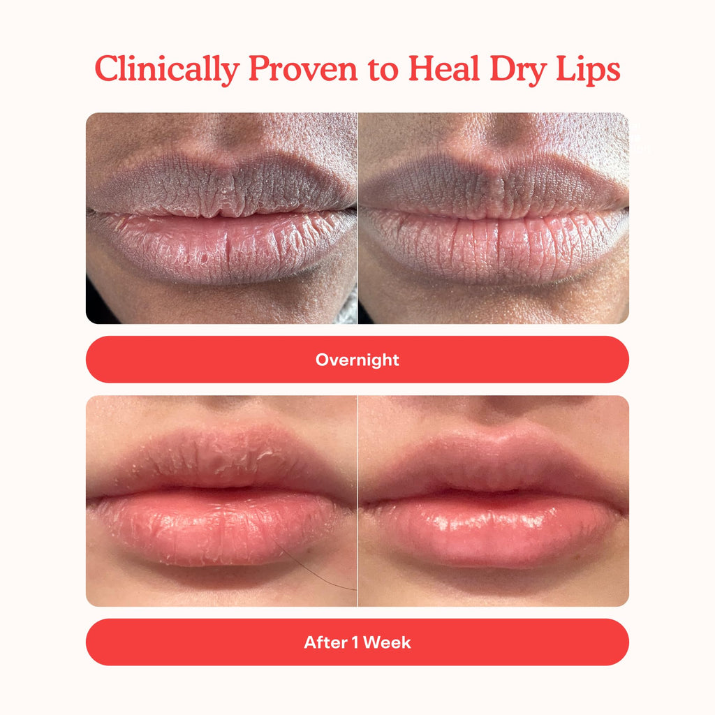 Tower 28 LipSoftie Tinted Lip Balm Treatment – Hydrating Glossy Balm + Overnight Lip Mask, SOS Vanilla