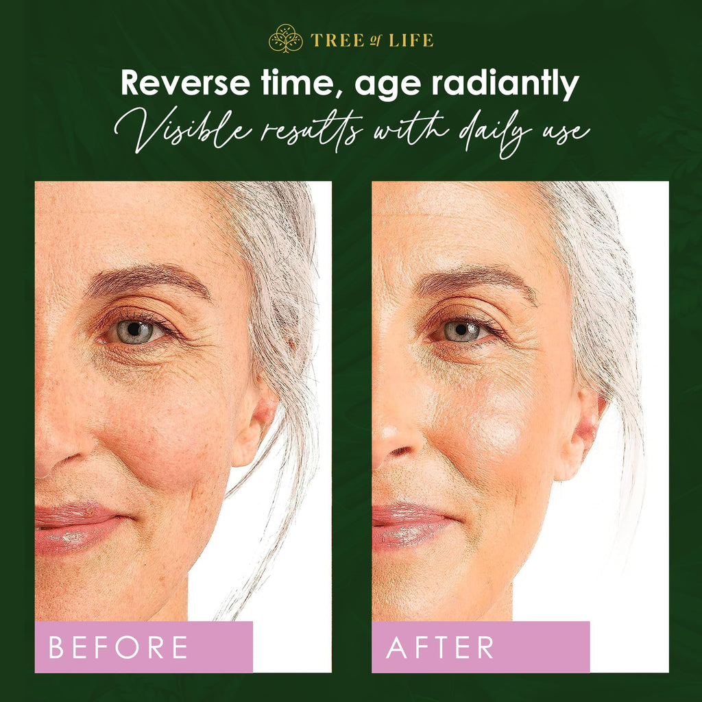 Tree of Life Beauty Retinol Serum – Hydrating Face Oil for Dark Spots & Fine Lines, 2 Fl Oz