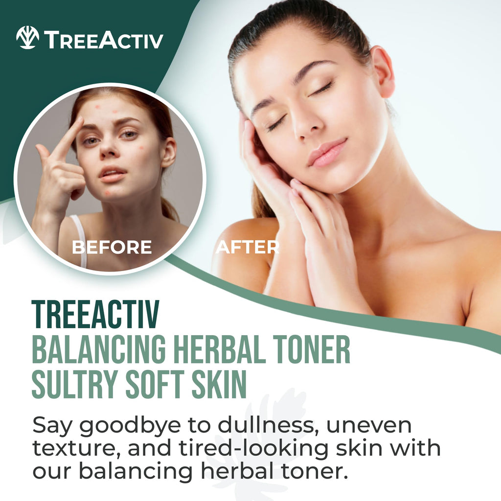 TreeActiv Balancing Herbal Toner | Alcohol-Free Astringent for Oily/Acne-Prone Skin | Rose Water & Tea Tree | 4 fl oz