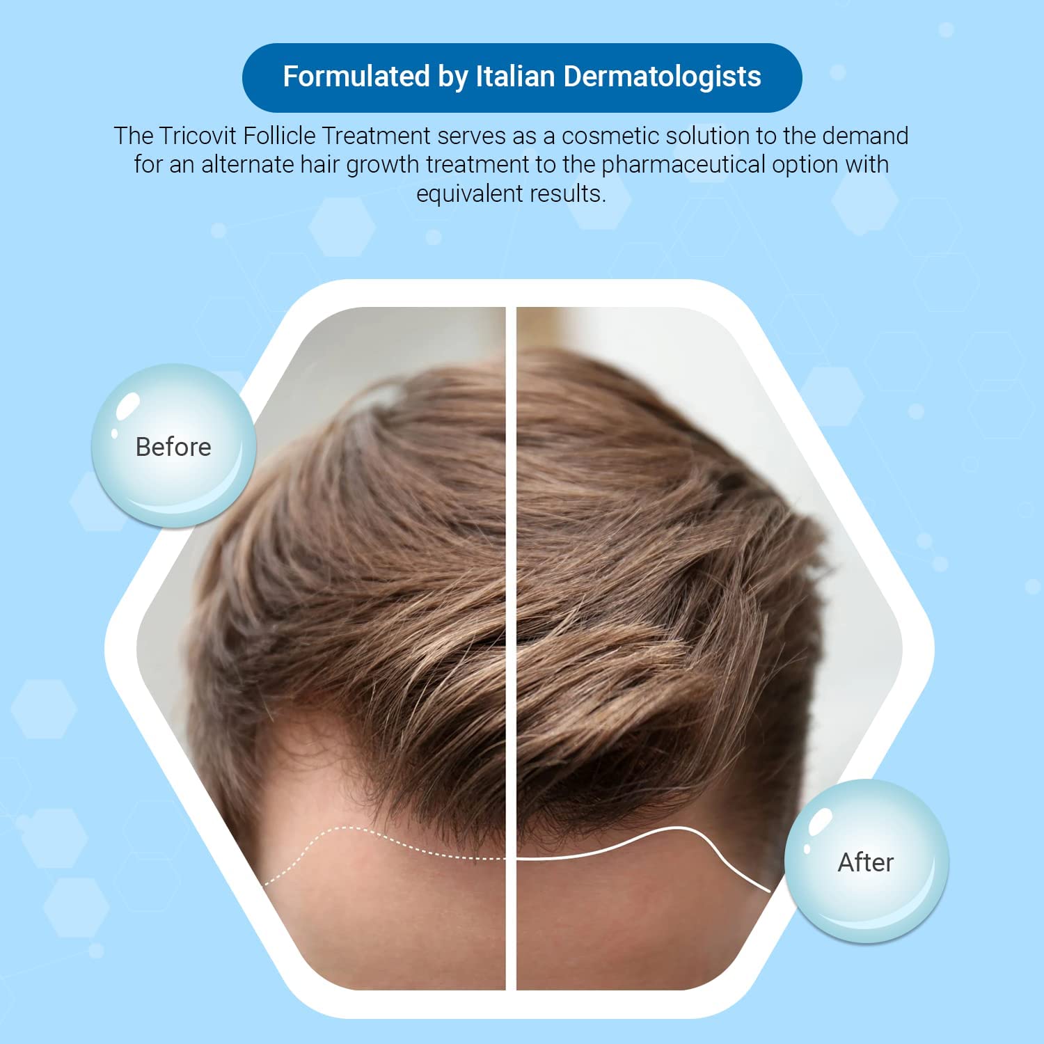 Tricovit Hair Growth Shampoo for Women & Men – Scalp Treatment, Hydration & Regeneration (8.4 oz)