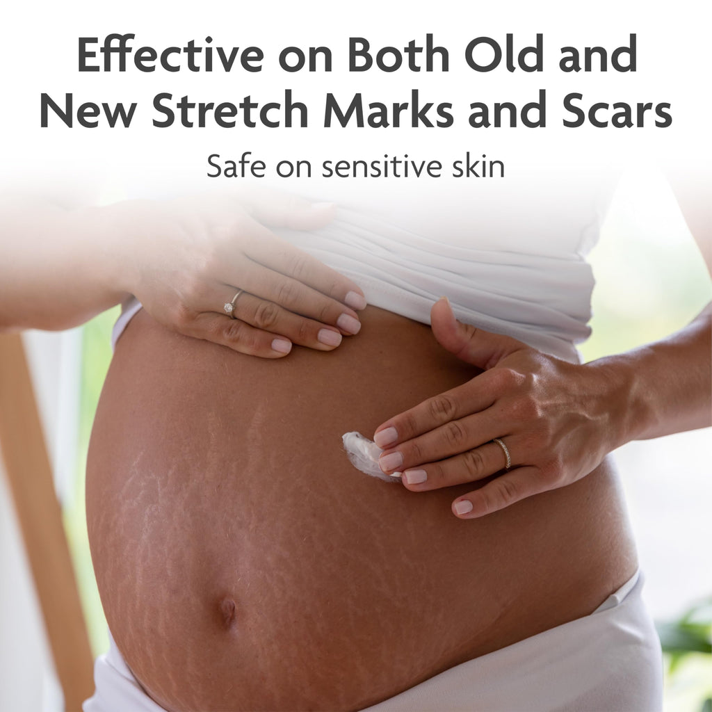 TriLASTIN Stretch Mark Cream — Collagen-Boosting Maternity Lotion (5.5 oz, Unscented, Paraben-Free)