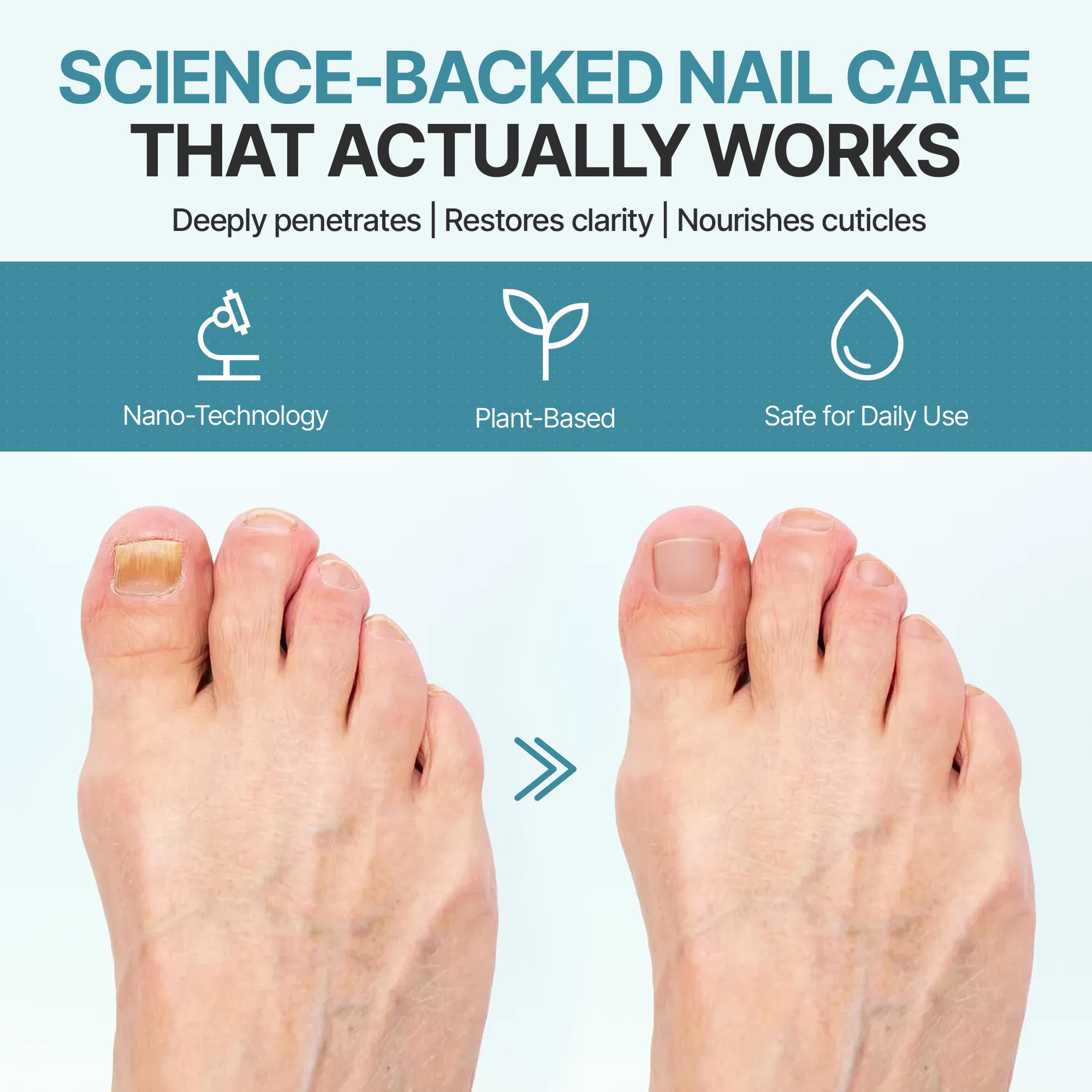 Triple Clear HF Nano Nail Strengthener Oil - Plant-Based Nail Therapy for Damaged Nails (0.5 fl oz)