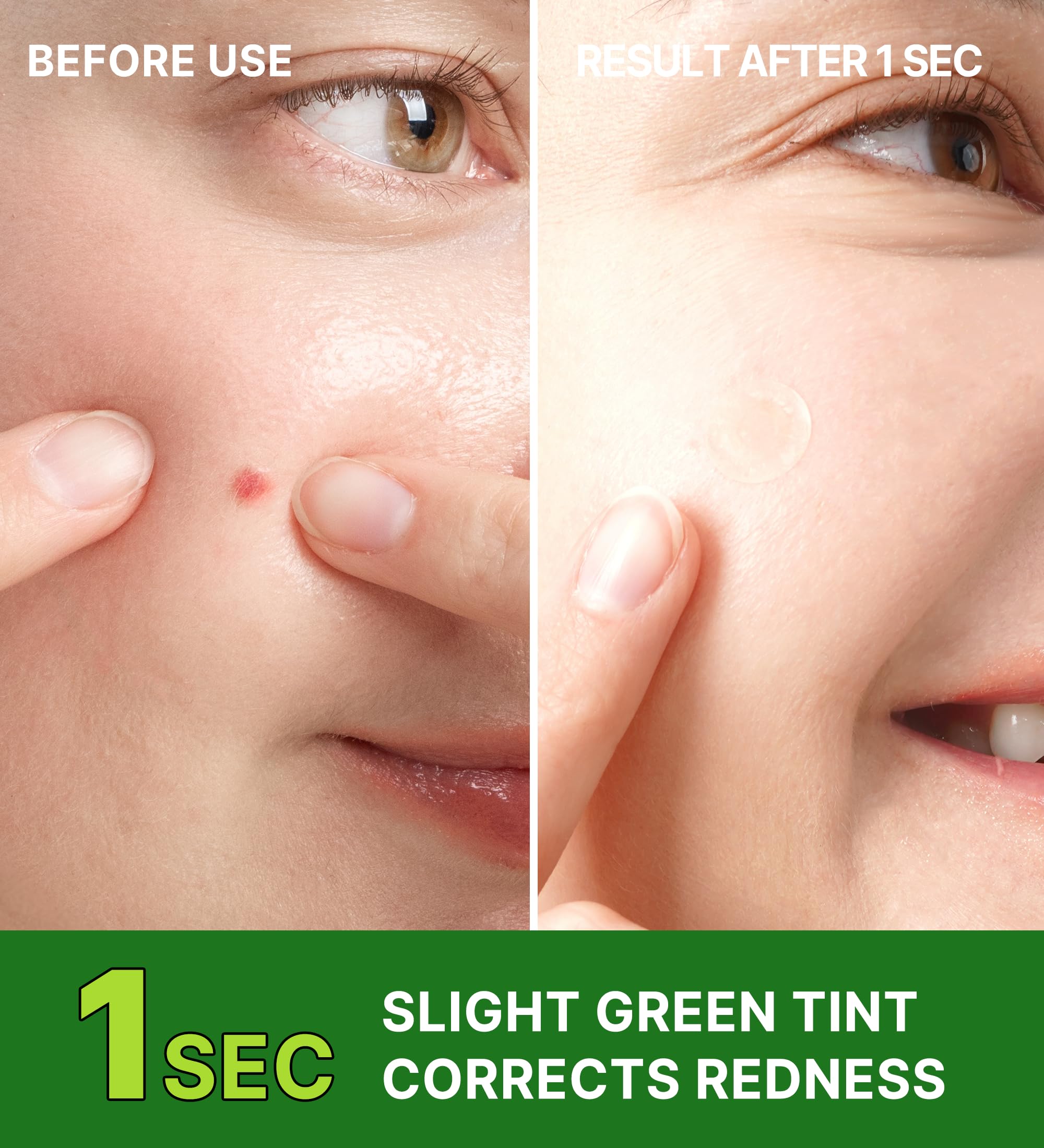 Troubless Invisible Plus Spot Patch The Red Correct – Redness-Targeting Hydrocolloid Patch (96 ea)