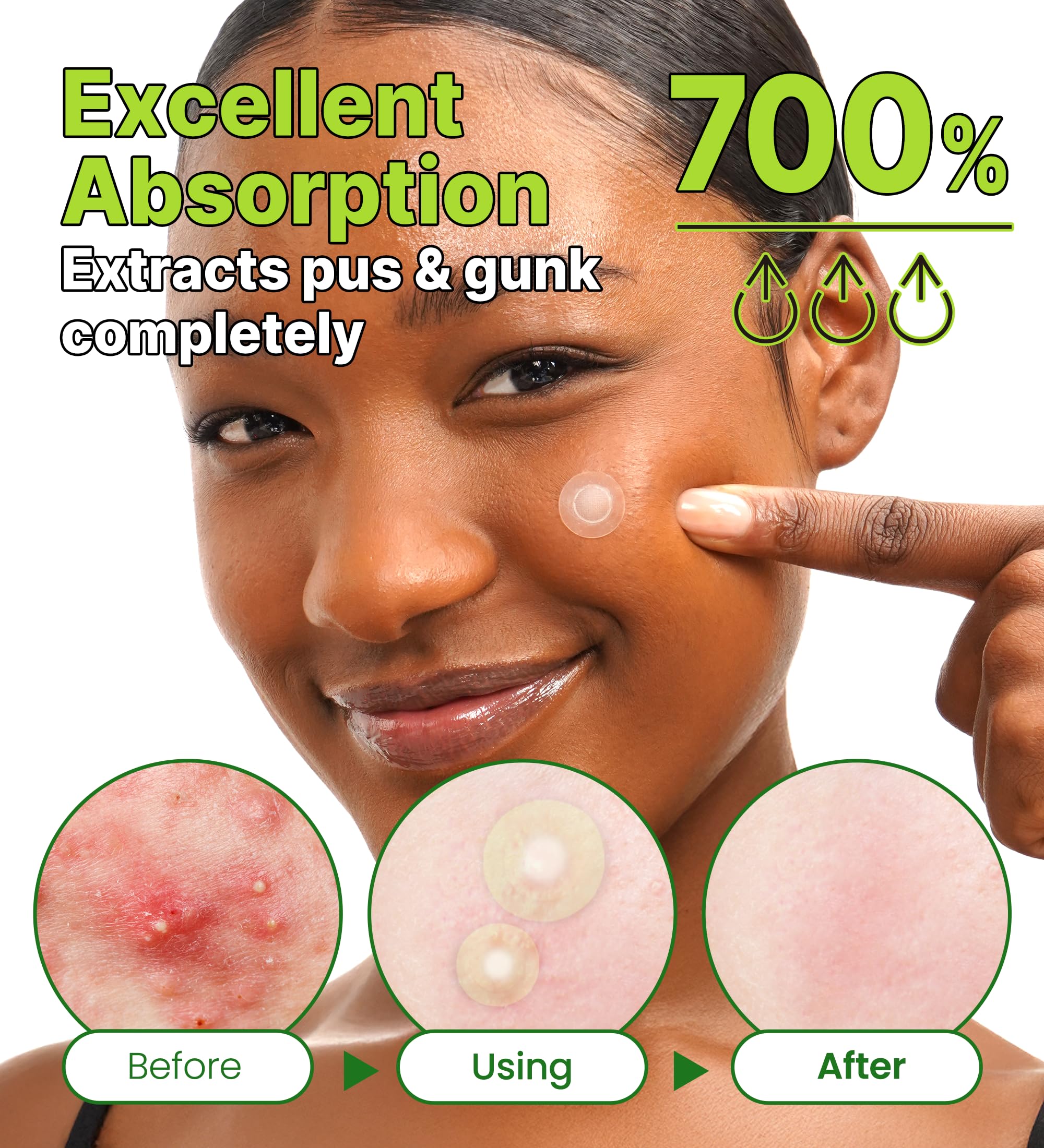 Troubless Invisible Plus Spot Patch The Red Correct – Redness-Targeting Hydrocolloid Patch (96 ea)