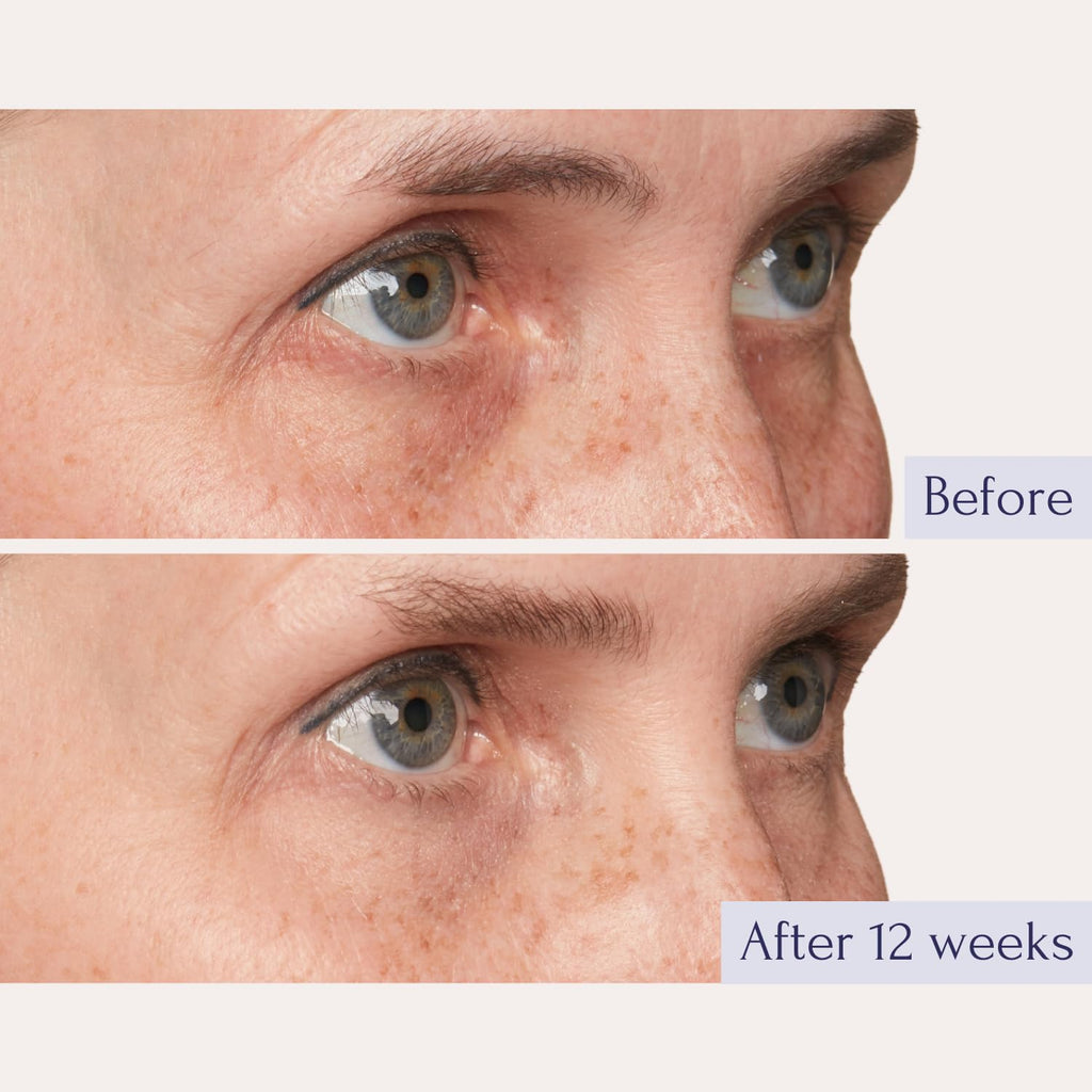 Tru Alchemy Eye Elixir Cooling Eye Treatment Cream – Puffiness, Dark Circles & Fine Lines