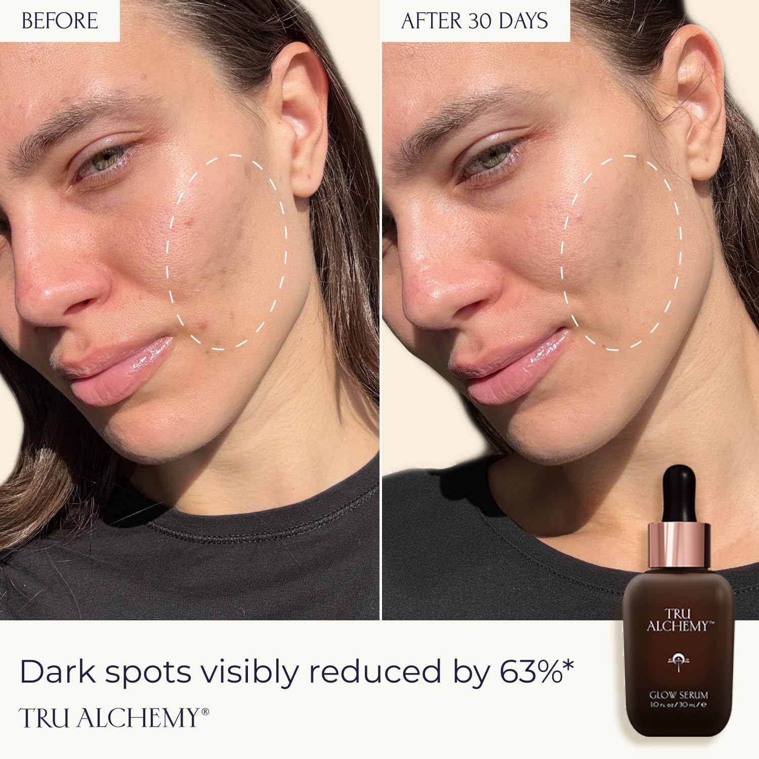 Tru Alchemy Vitamin C Glow Serum – Hydrating Brightening Serum with Bakuchiol, Glycolic & Lactic Acid | 1 fl oz