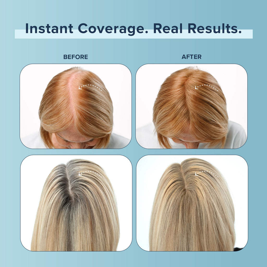 TRUHAIR Color Fibers: Root Coverage & Density Booster – 11 Shades