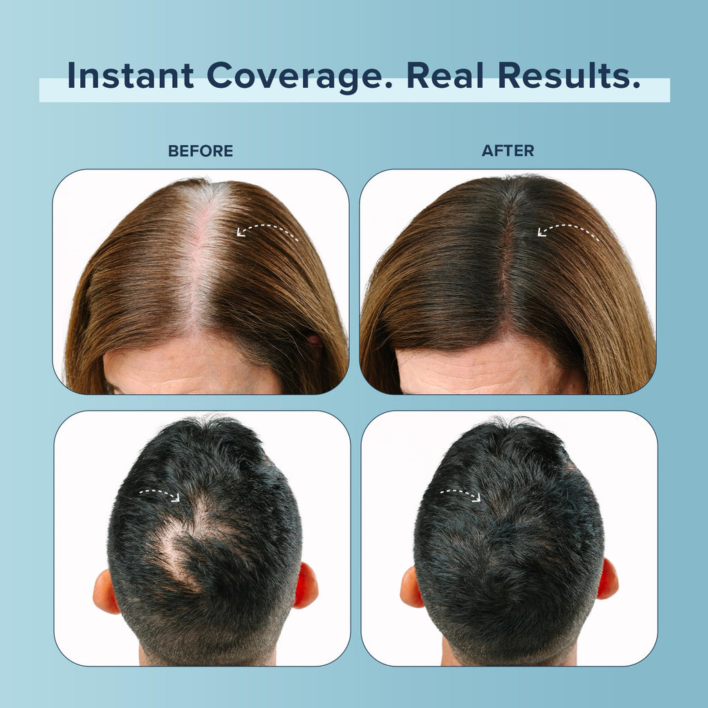 TRUHAIR Color Fibers: Root Coverage & Density Booster – 11 Shades