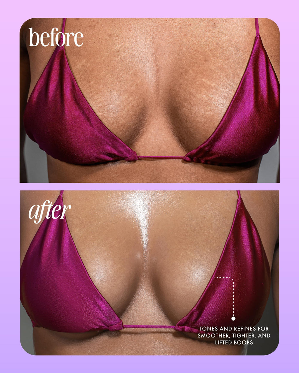 Truly Beauty Acai Your Boobies Serum – Bust Firming, Skin Elasticity, 3.1 oz