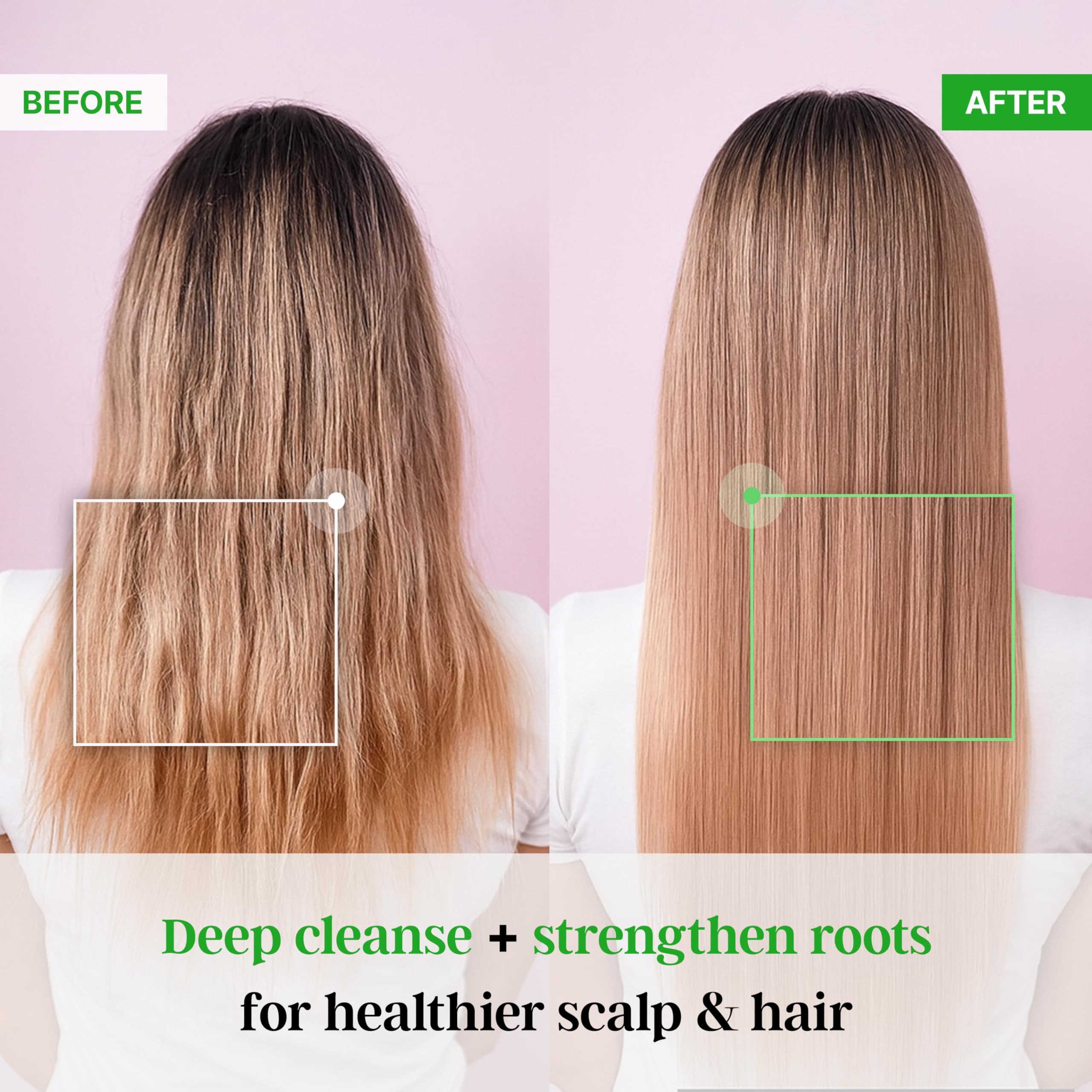 TS SHAMPOO Premium Biotin Shampoo for Hair Support – 10.14 oz / 300 g (Korean formula)
