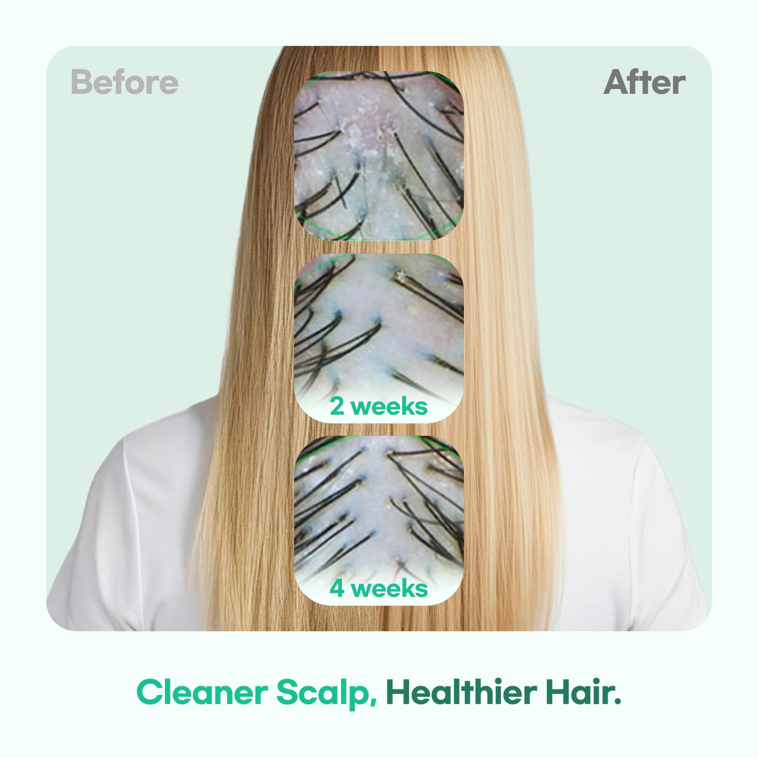 TS GD Shampoo for Flake-Prone Scalp – Teen-Friendly, Silicone/SLS/SLES Free (14.1 oz) | Korean Hair Care