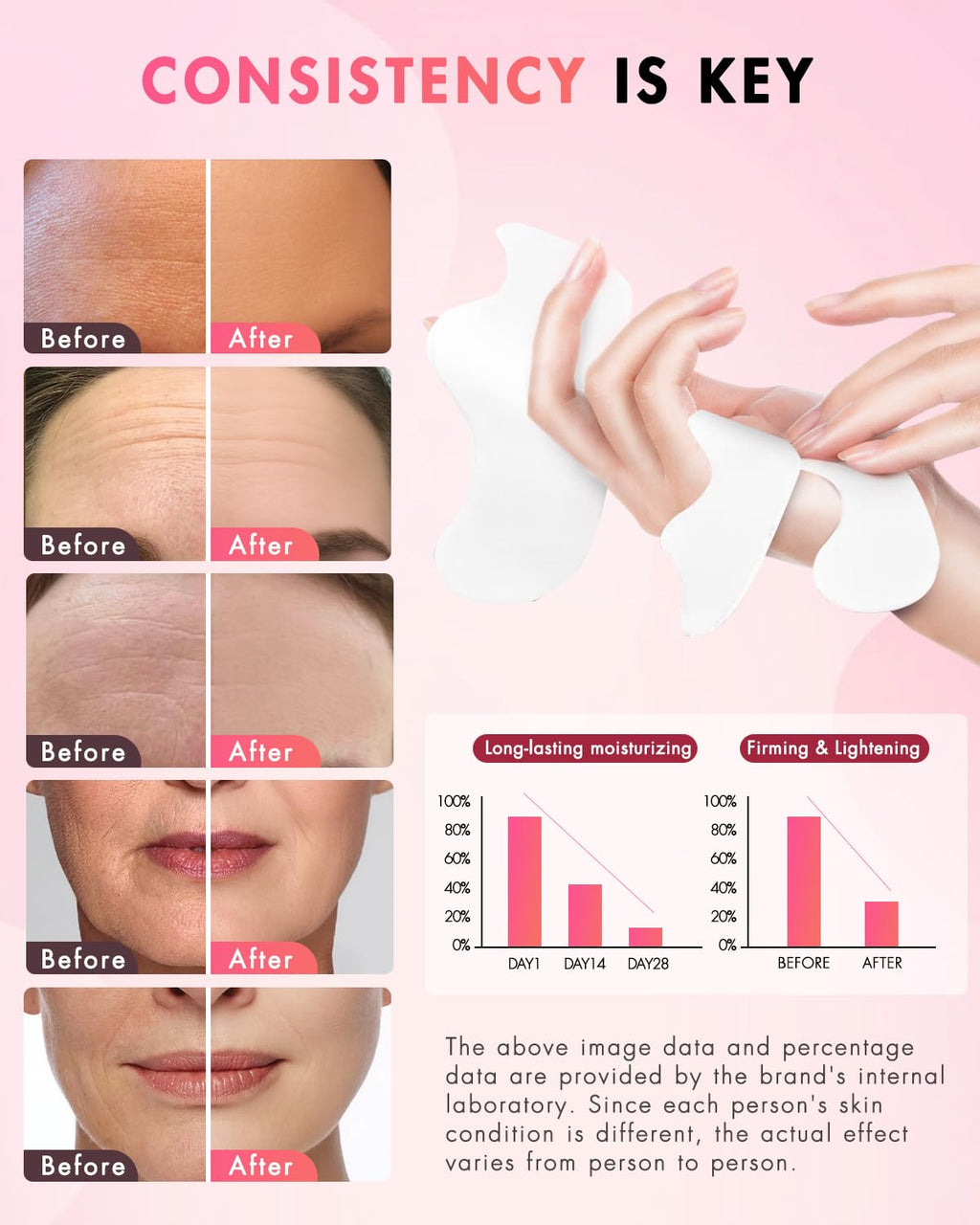 UKVOA Forehead Wrinkle Patches & Smile Line Patches – Overnight Hydration & Subtle Lift