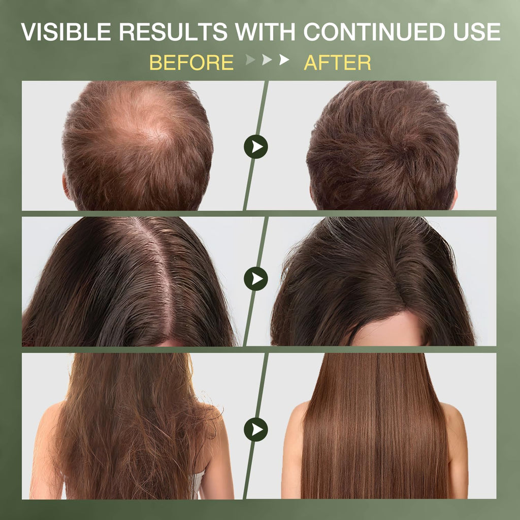 ulluxe Raw Batana Oil – 100% Natural Unrefined Hair Growth Oil from Honduras