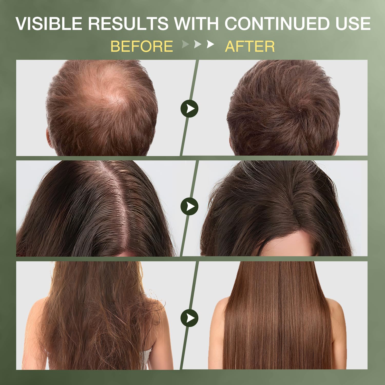 ulluxe Raw Batana Oil – 100% Natural Unrefined Hair Growth Oil from Honduras