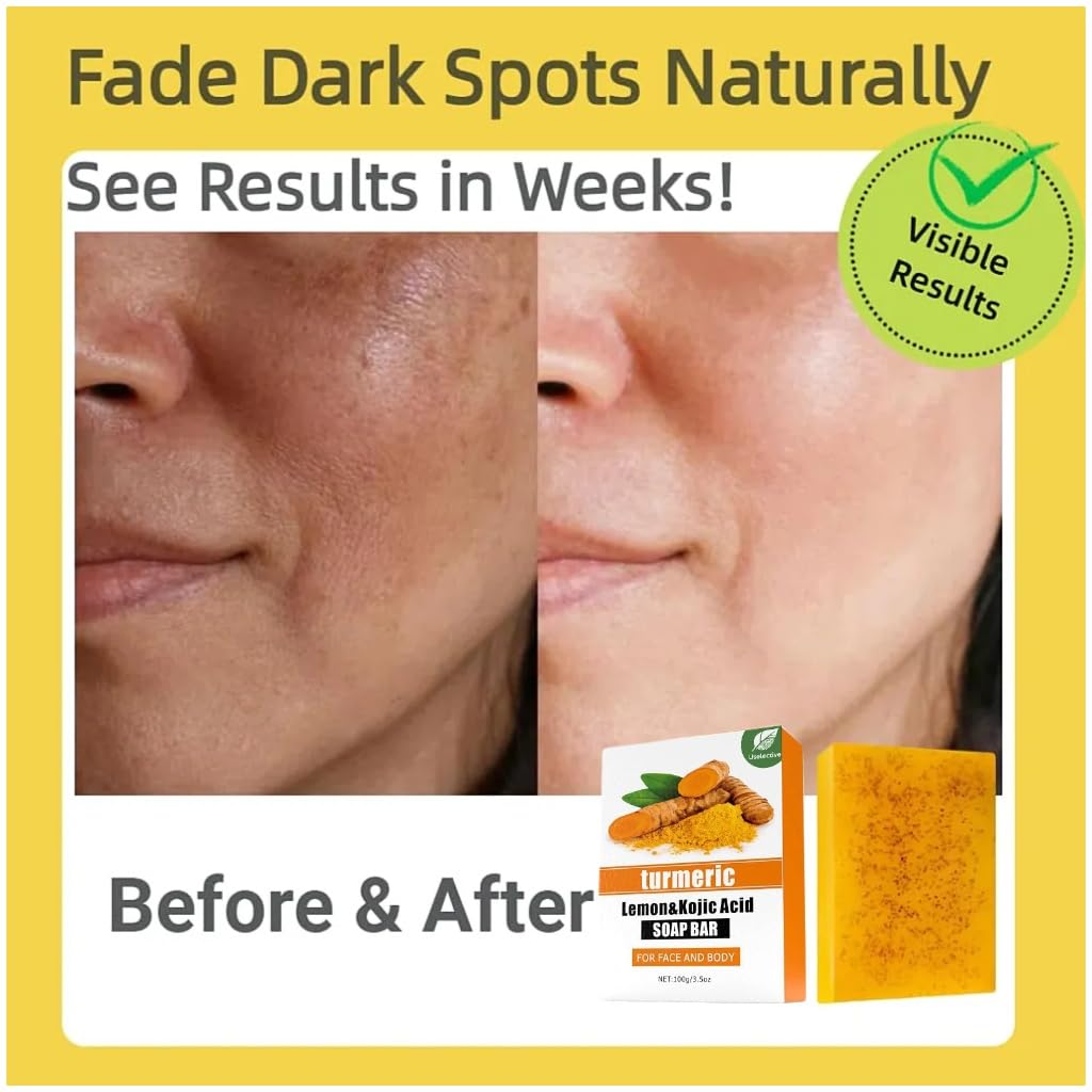 Uselective 2 Pack Turmeric & Lemon Glow Soap Bar – Kojic Acid, Vitamin C, Retinol, 3x Moisturizing, SLS Free