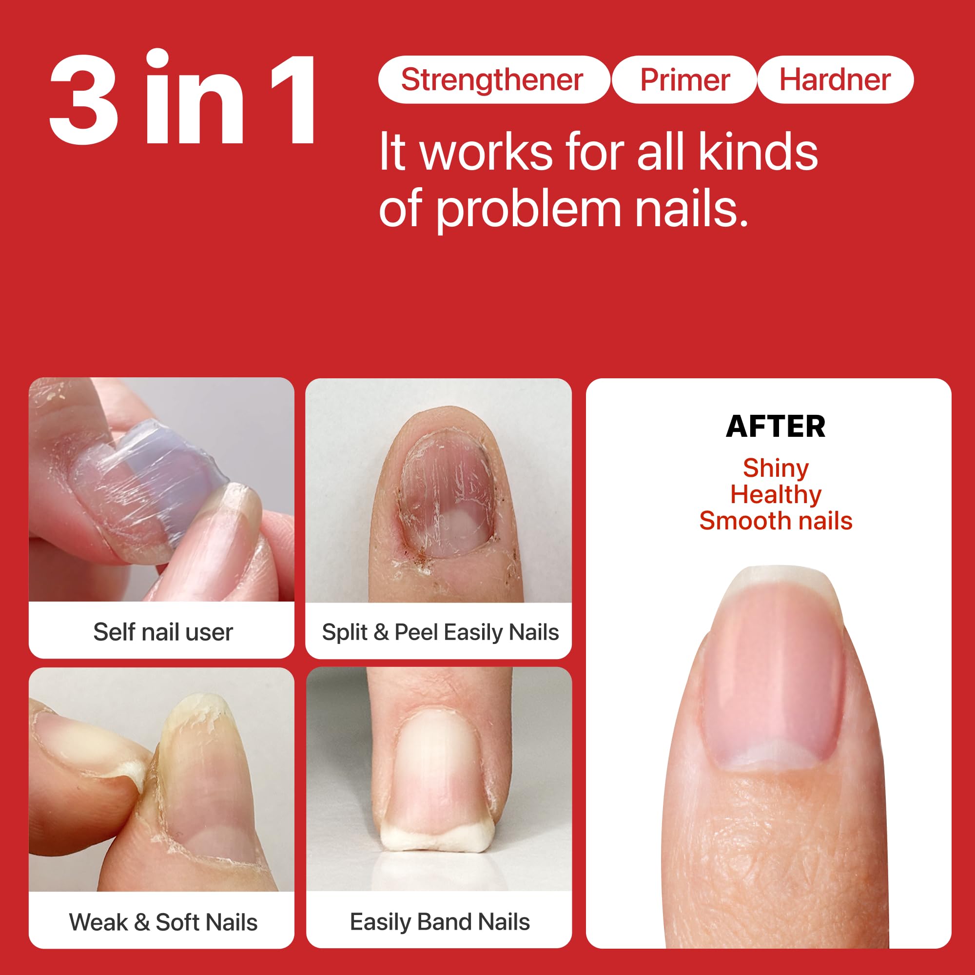 UUUUU Magical Nail Solution – All-In-One Nail Care, Quick-Drying & Non-Toxic