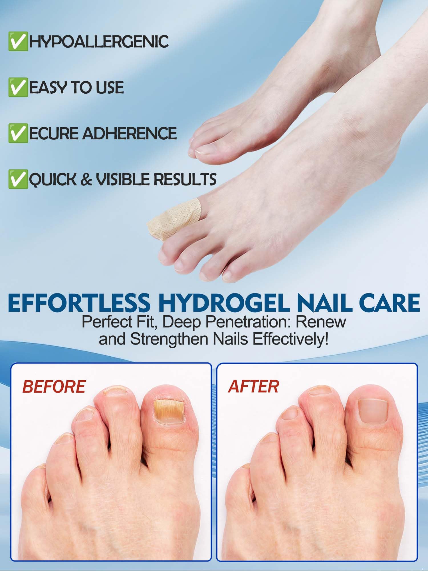 Vealvion Nail Patches — Extra Strength Overnight Nail Repair (8-Hour)