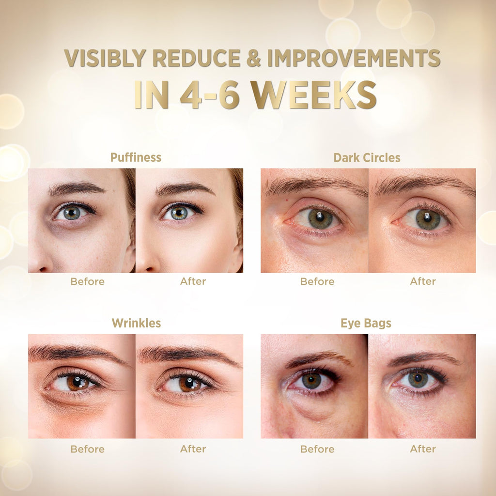 VELAMO ADVANCED 24K Gold Under Eye Patches – Retinol & Collagen Eye Masks for Puffiness, Dark Circles & Wrinkles | 60 Pcs