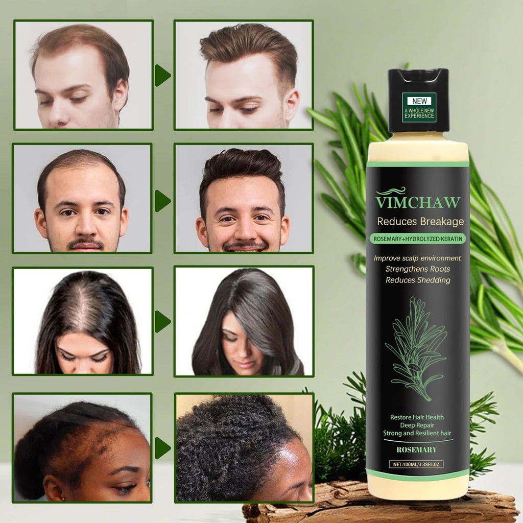Vimchaw Organic Rosemary Hair Growth Shampoo – Strengthening with Hydrolyzed Keratin