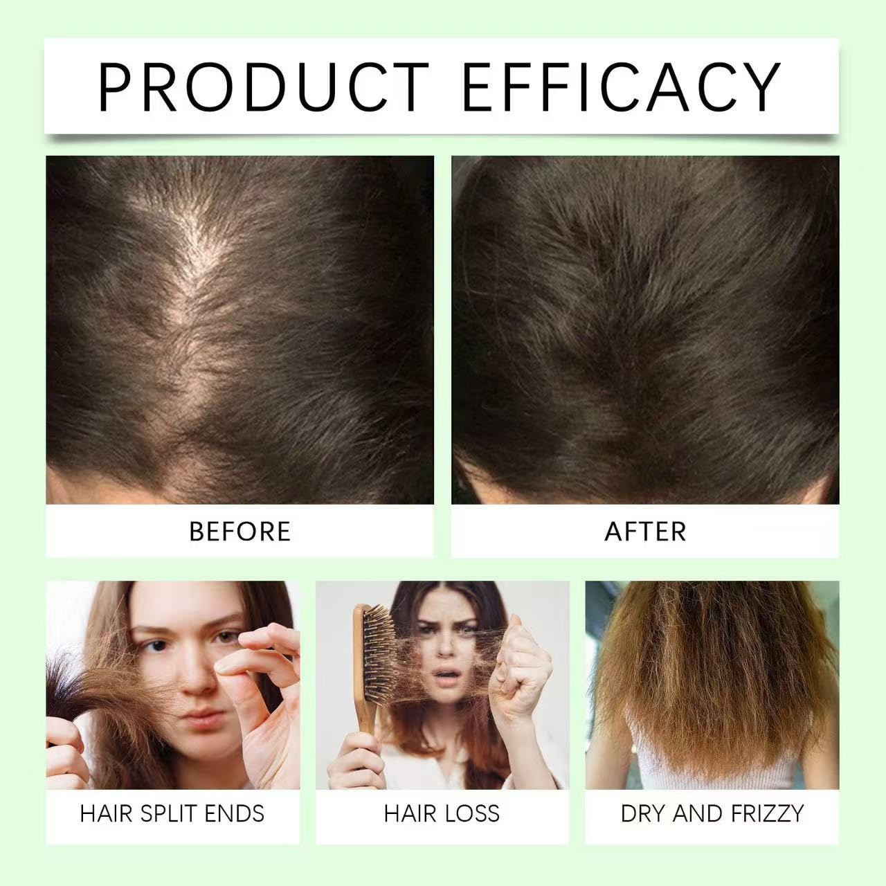 Vimchaw Rosemary Hair Growth Shampoo – Organic, Keratin-Infused for Thinning Hair (3x3.4 oz Pack)