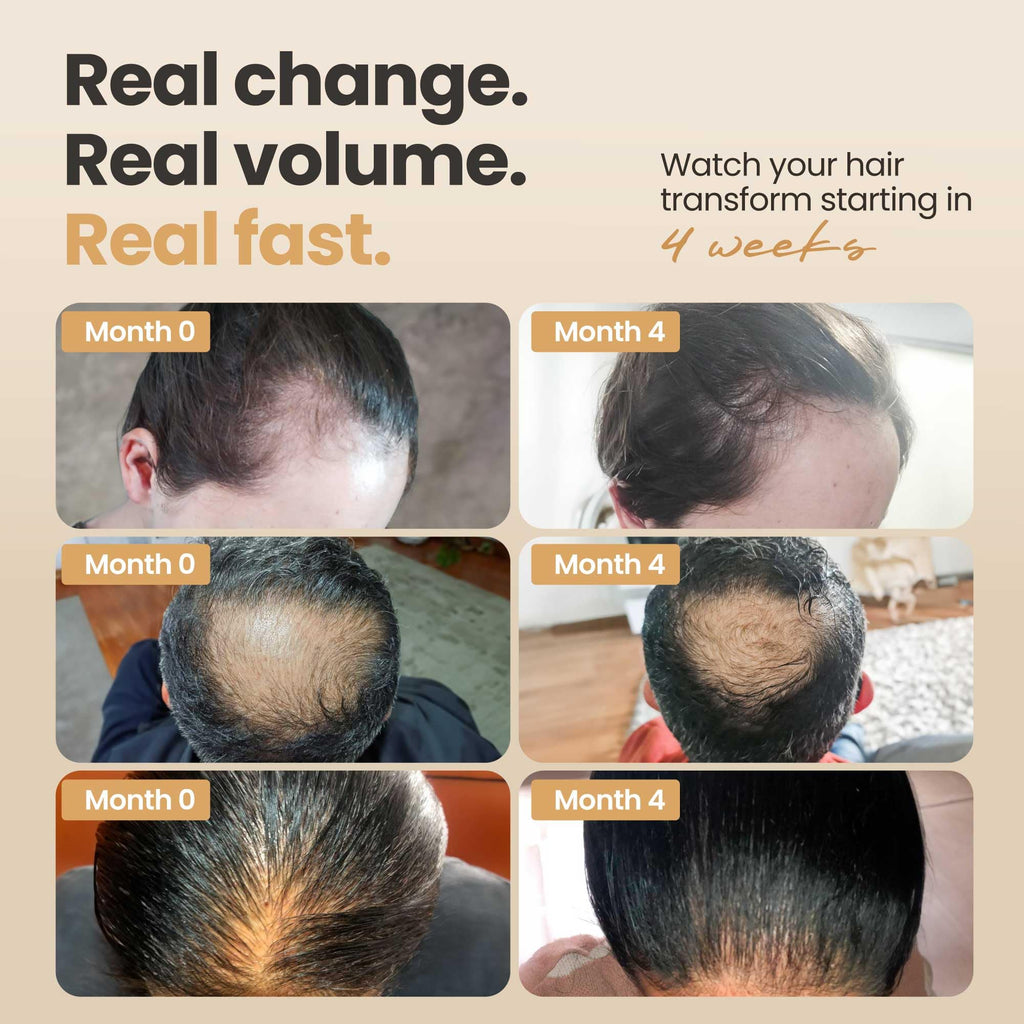 Vitasei Hair Booster 2 Fl Oz (3 Pack) – Capilia Longa, Wild Olive Stem Cells & Arginine for Thicker, Stronger Hair