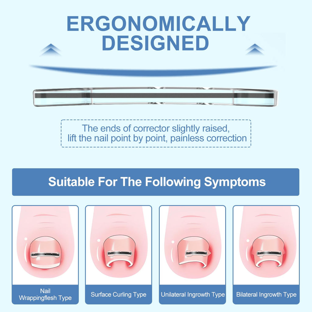 VITASY 12Pcs Ingrown Toenail Corrector Strips – 4 Sizes, Quick Home Relief Kit