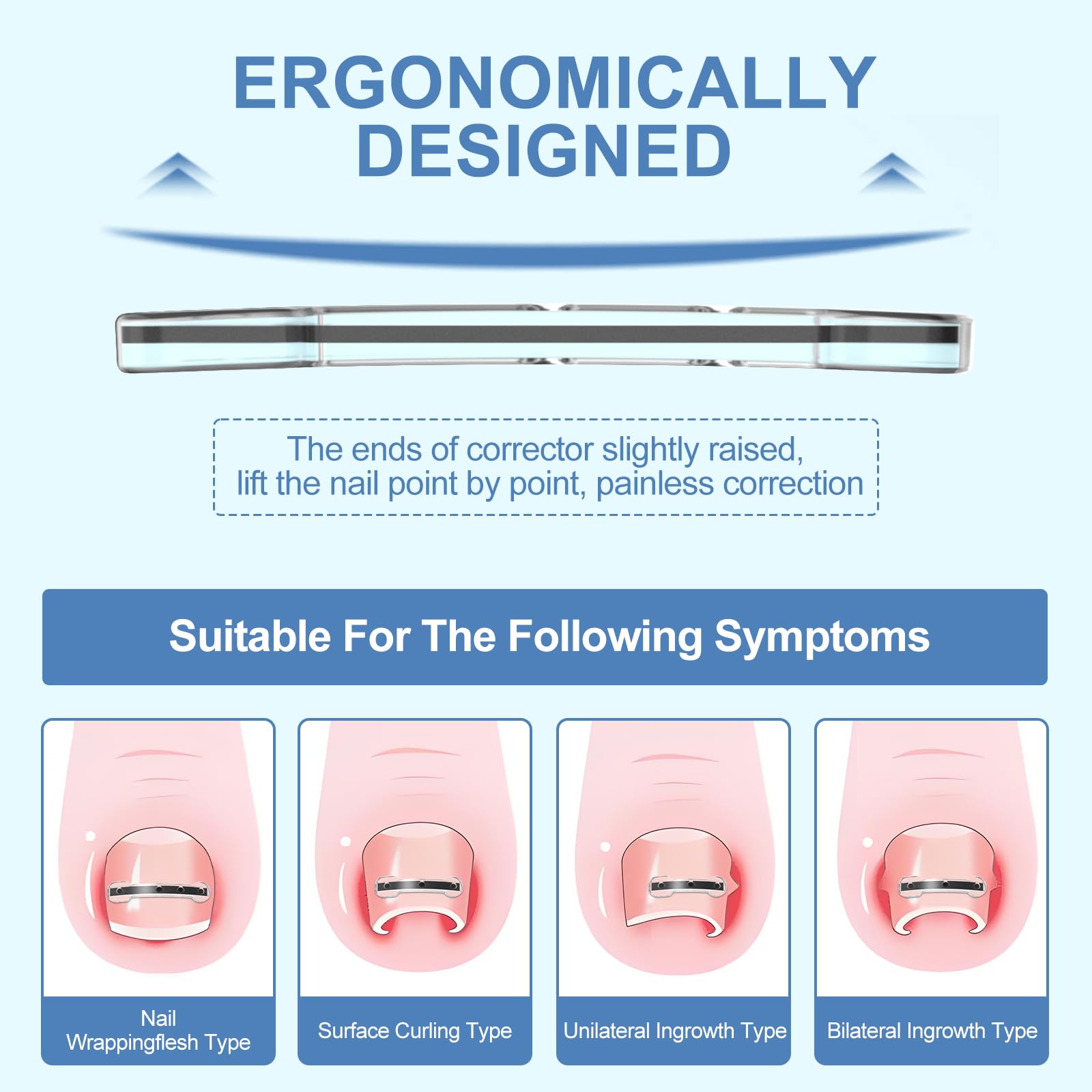 VITASY 12Pcs Ingrown Toenail Corrector Strips – 4 Sizes, Quick Home Relief Kit