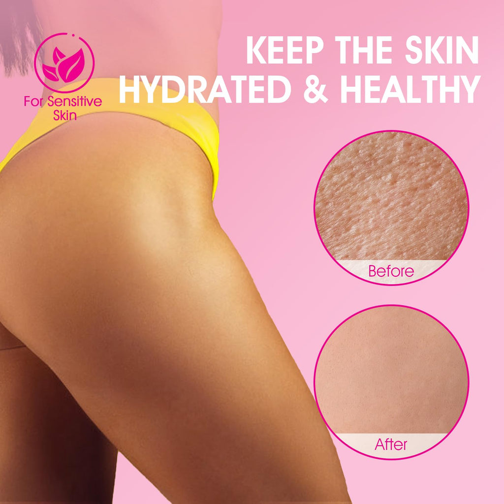 VOERUY Bikini Area Exfoliator – 10% AHA+BHA with Turmeric for Smoother Skin and Fewer Ingrown Hairs