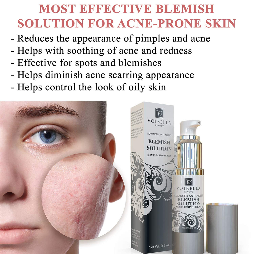Voibella Beauty Blemish Spot Treatment Cream – Gentle Serum for Acne-Prone Skin