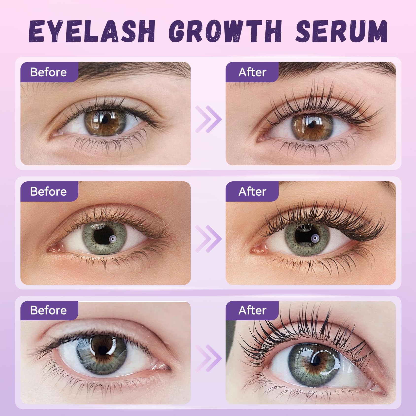 Vxzit Lash Serum | Gentle Natural Vegan Eyelash Growth & Nourishing Treatment 5ml