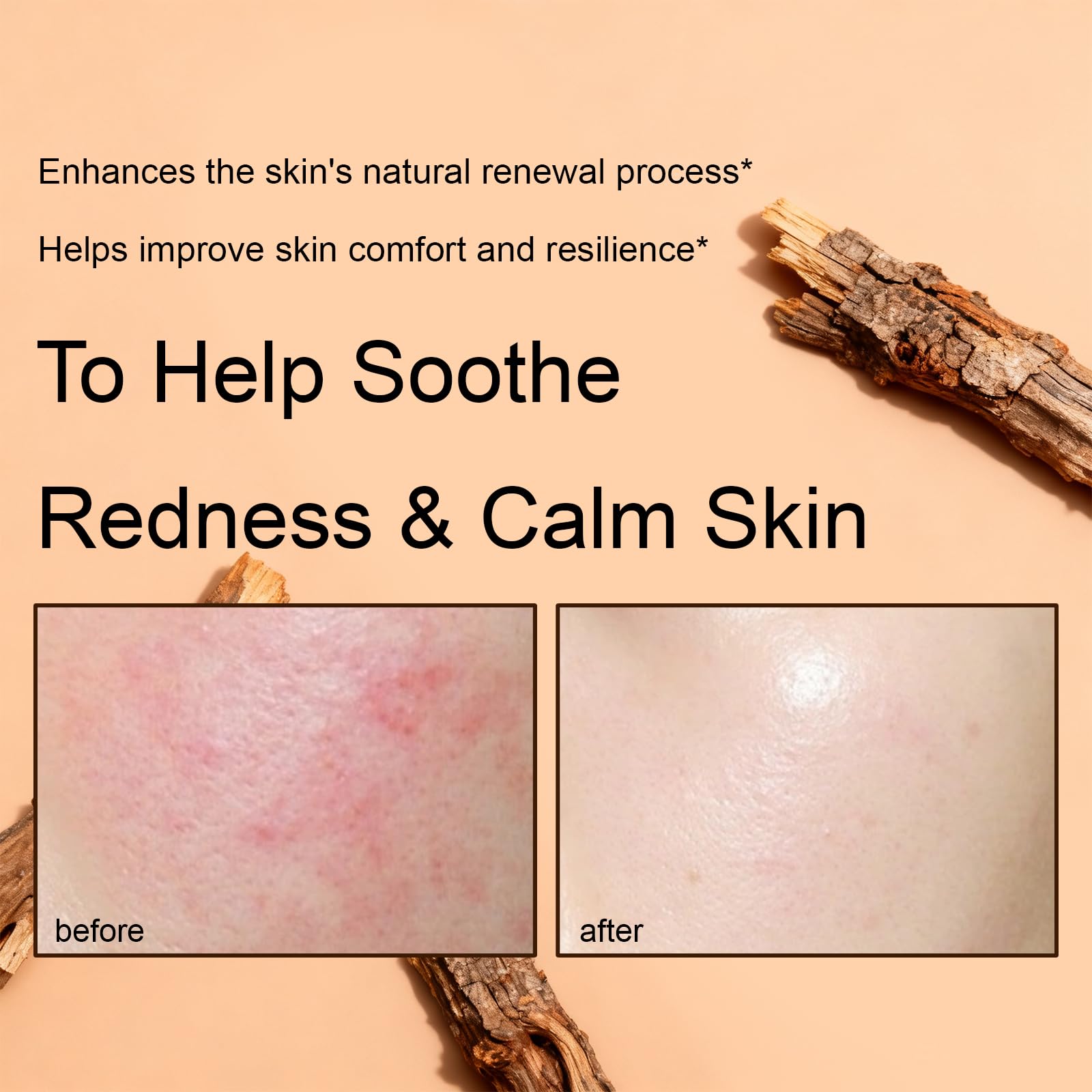 XUHUIT Advanced PDRN Rejuvenating Cream – 99% Salmon DNA, Hyaluronic Acid & Niacinamide