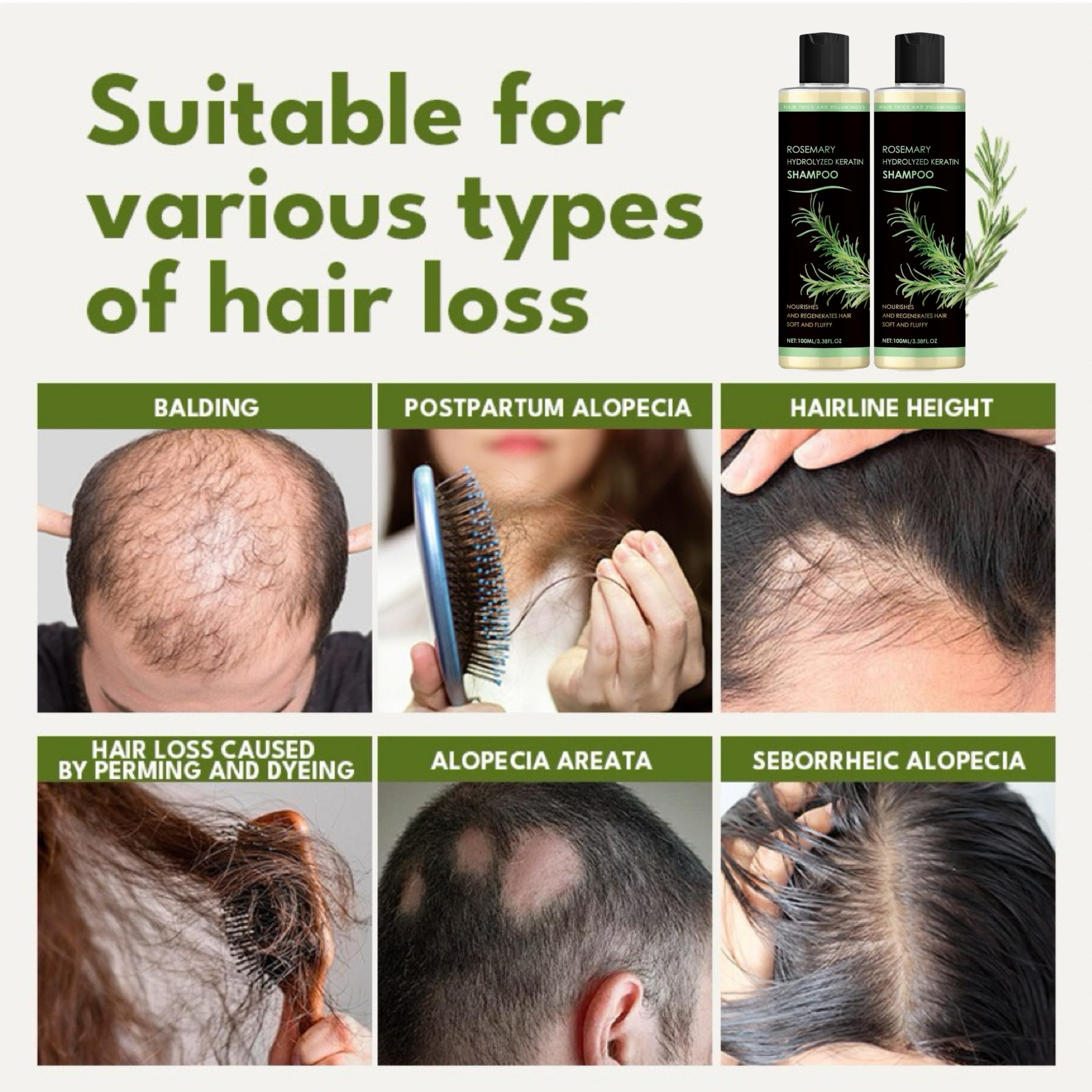 XYFSZDQJZHG Rosemary Hair Growth Shampoo – Keratin + Rosemary Oil for Thinning Hair (2 Pcs)