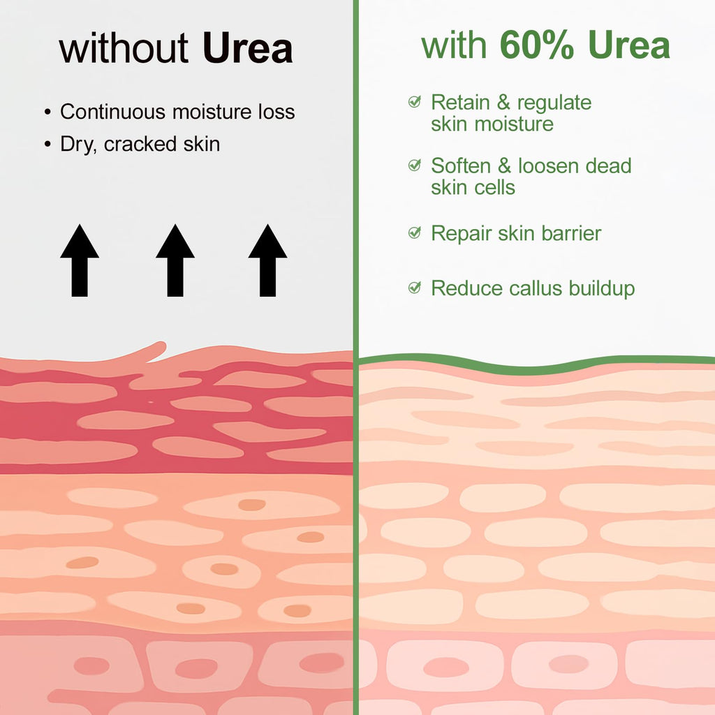 YAFUSIPE Urea Cream 60% Foot Care with Salicylic Acid 2% | Intensive Foot Moisturizer