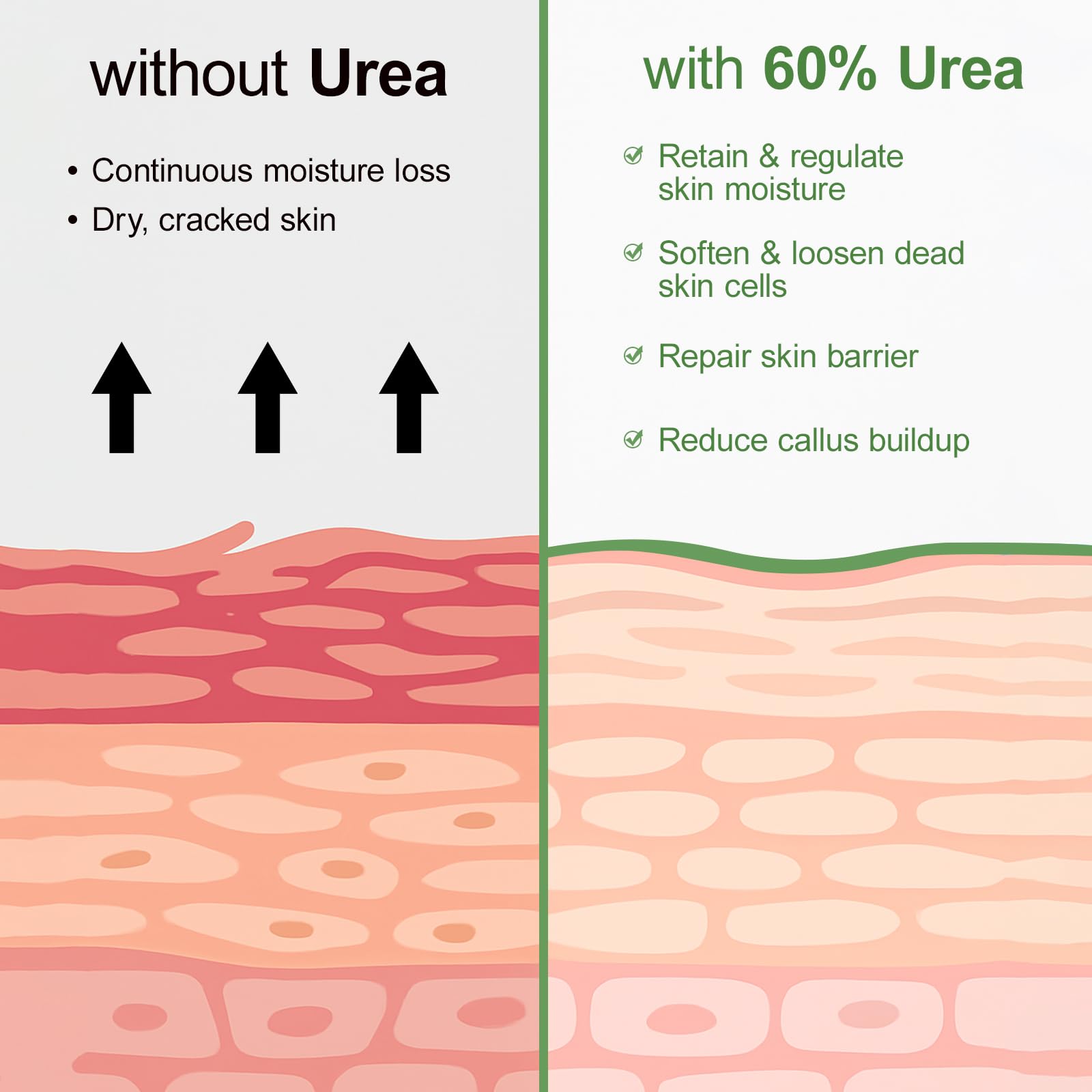 YAFUSIPE Urea Cream 60% Foot Care with Salicylic Acid 2% | Intensive Foot Moisturizer