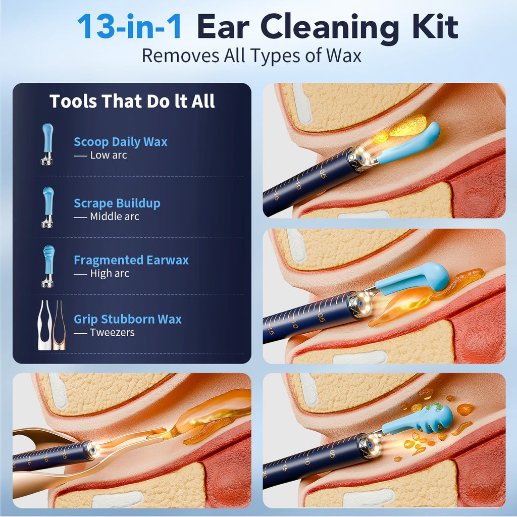 Yakbio Ear Cleaner with Camera 1296P HD - 6 LED Lights, Wireless Ear Wax Removal Kit