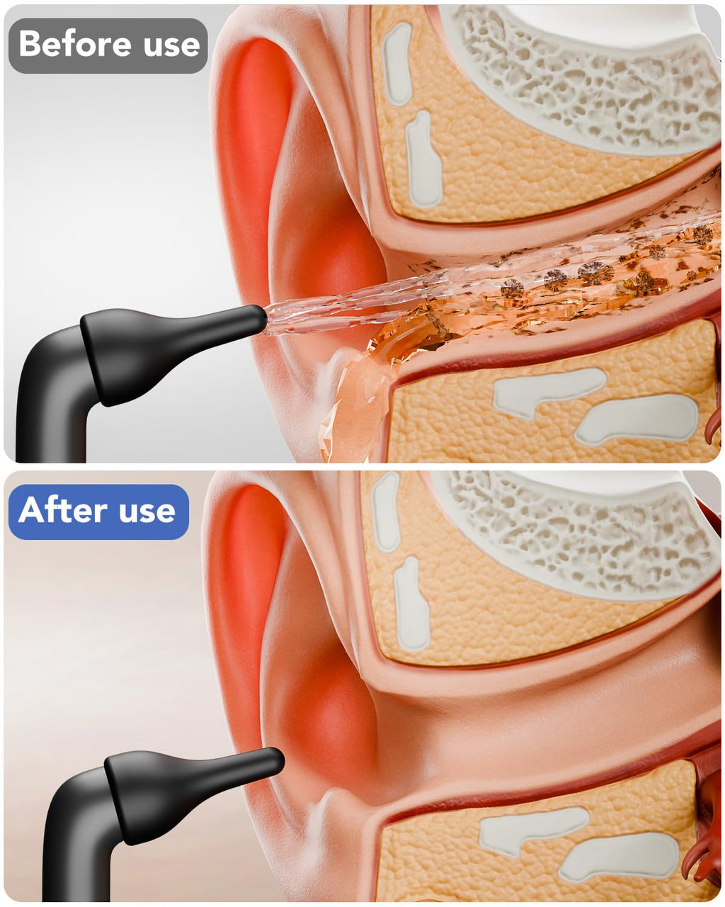 Yakbio Electric Ear Wax Removal Kit | Water-Powered Ear Cleaner, 3 Modes, 12 Tips, IPX7, USB Rechargeable