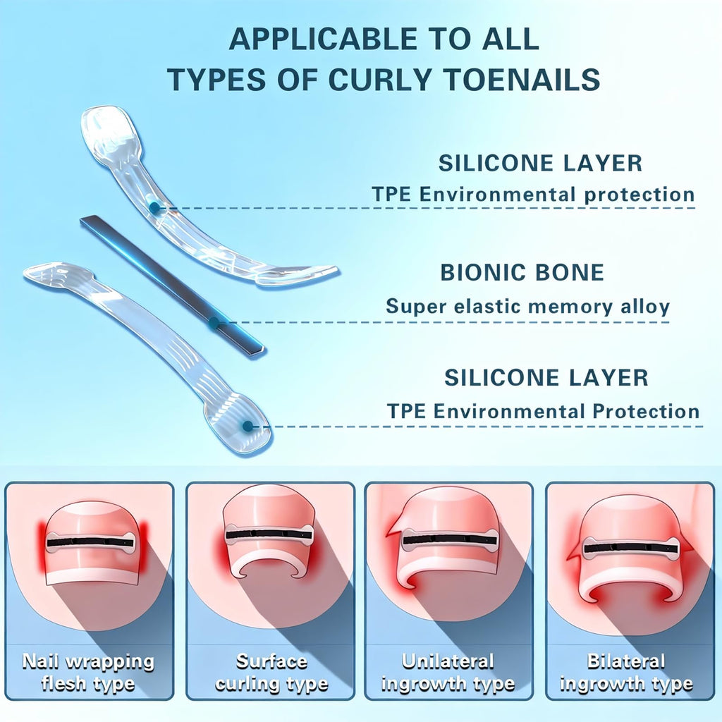 Yin Aawaeao Titanium Alloy Ingrown Toenail Treatment — Waterproof Patch Kit for Curved Nails