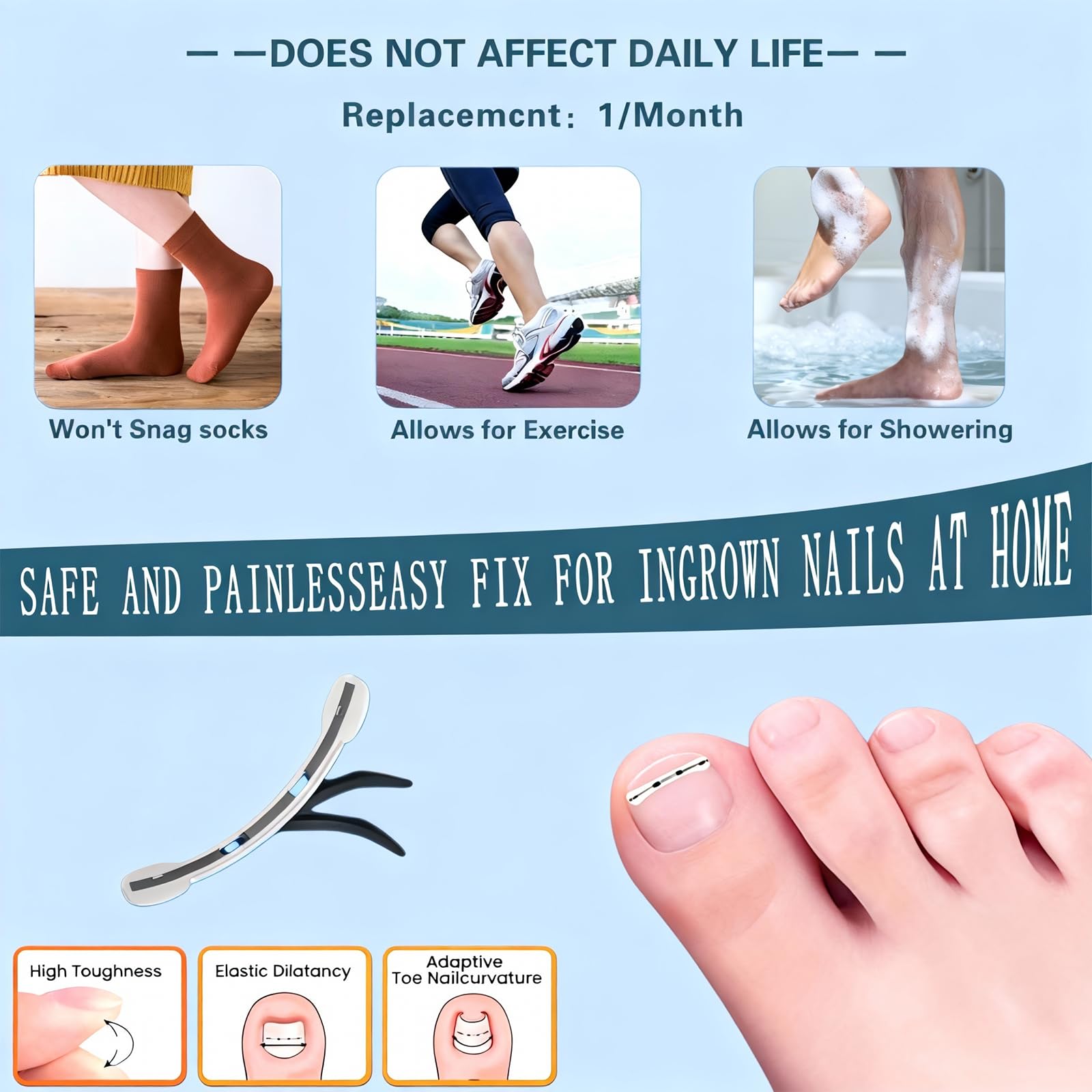 Yin Aawaeao Titanium Alloy Ingrown Toenail Treatment — Waterproof Patch Kit for Curved Nails