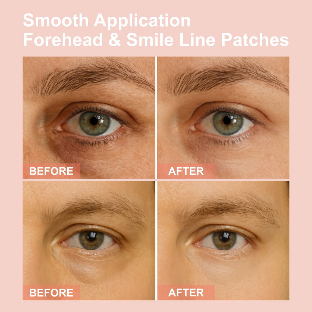 YLOTRE Novalift Micro Eye Patches – Deep Hydration for Puffy Eyes, Dark Circles & Fine Lines