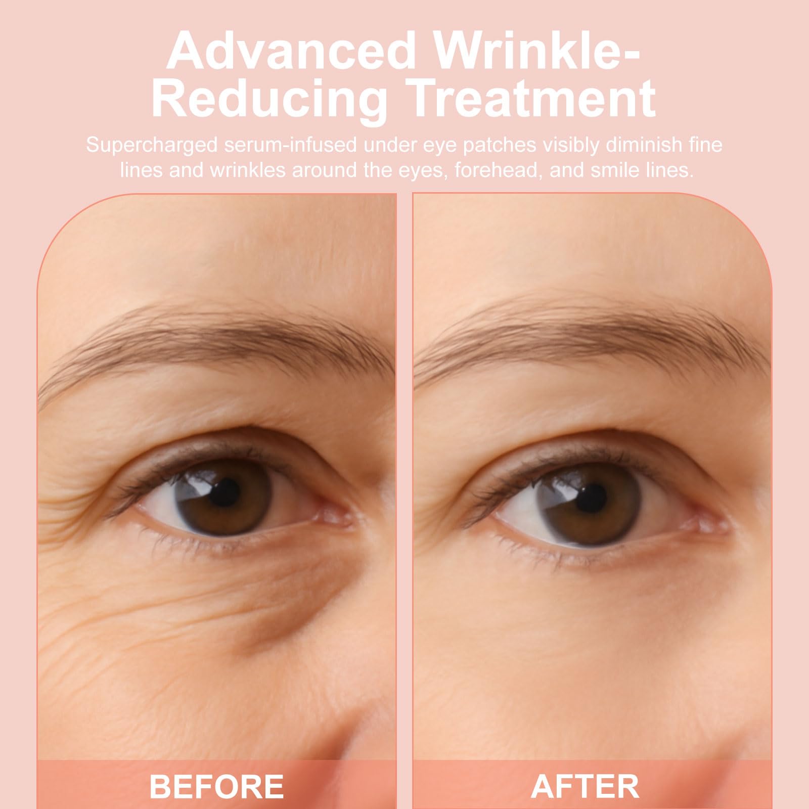 YLOTRE Novalift Micro Eye Patches – Deep Hydration for Puffy Eyes, Dark Circles & Fine Lines