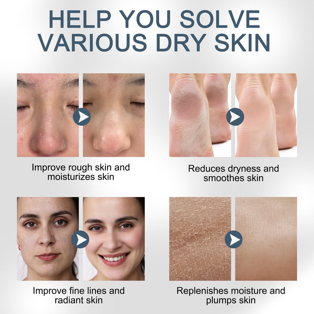 YMEYFAN Pure Hyaluronic Acid Powder for DIY Serums – 33 oz Yield, Cosmetic Grade, Non-GMO