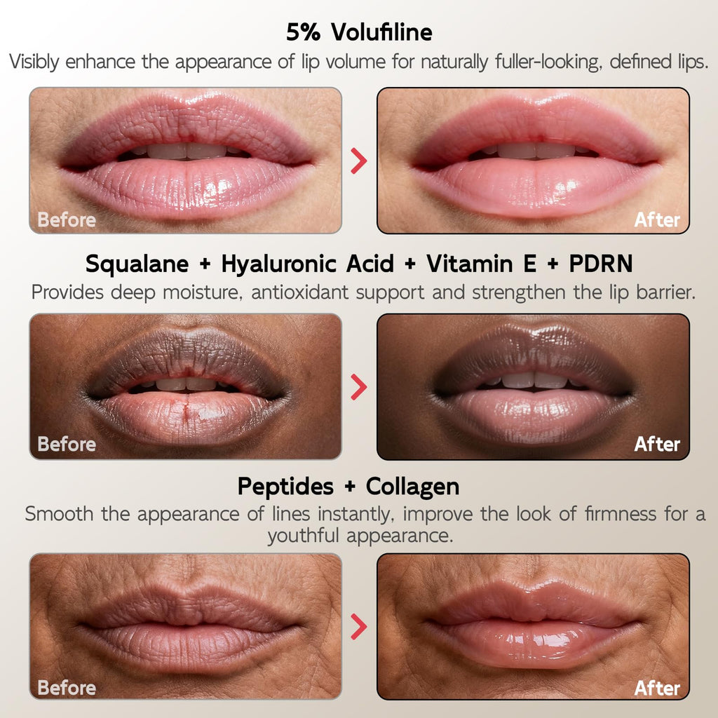 YouthVibe 5% Volufiline Lip Plumper – Gentle Daily Plumping with Squalane, Peptides & PDRN