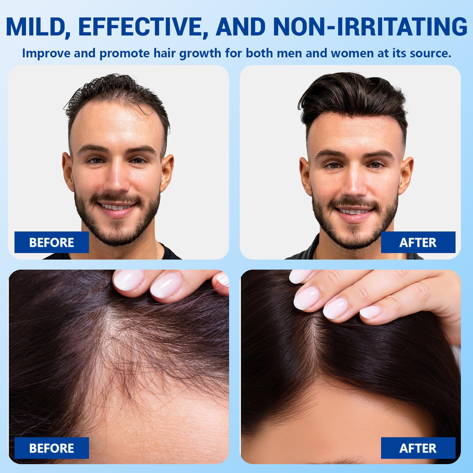YUFUY Hair Growth Serum Roll-On – No-Rinse, Fast-Absorbing with Rosemary, Castor, Batana Oil & Biotin Niacinamide