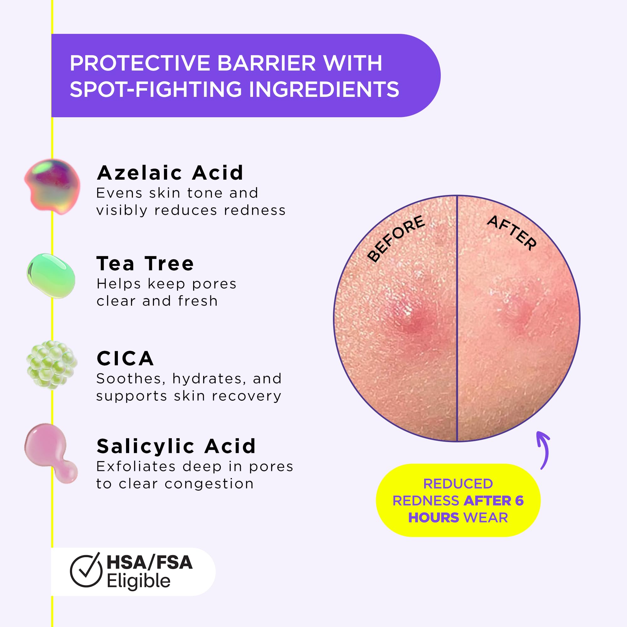 ZitSticka Liquid Pimple Patch – Invisible, Customizable Gel for Face (0.3oz / 10ml)
