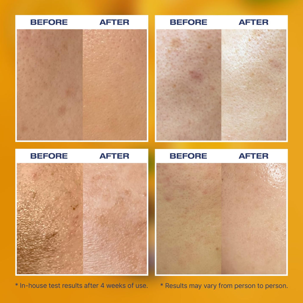 ZOLOPIX MINTAVI20 20% Vitamin C Serum — Brightening & Even Tone (26ml)