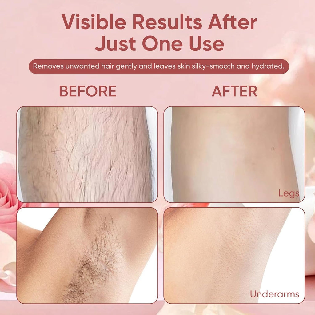 Zoreni No Shave Hair Removal Cream for Women – Gentle, Vitamin E & B5, 150 ml